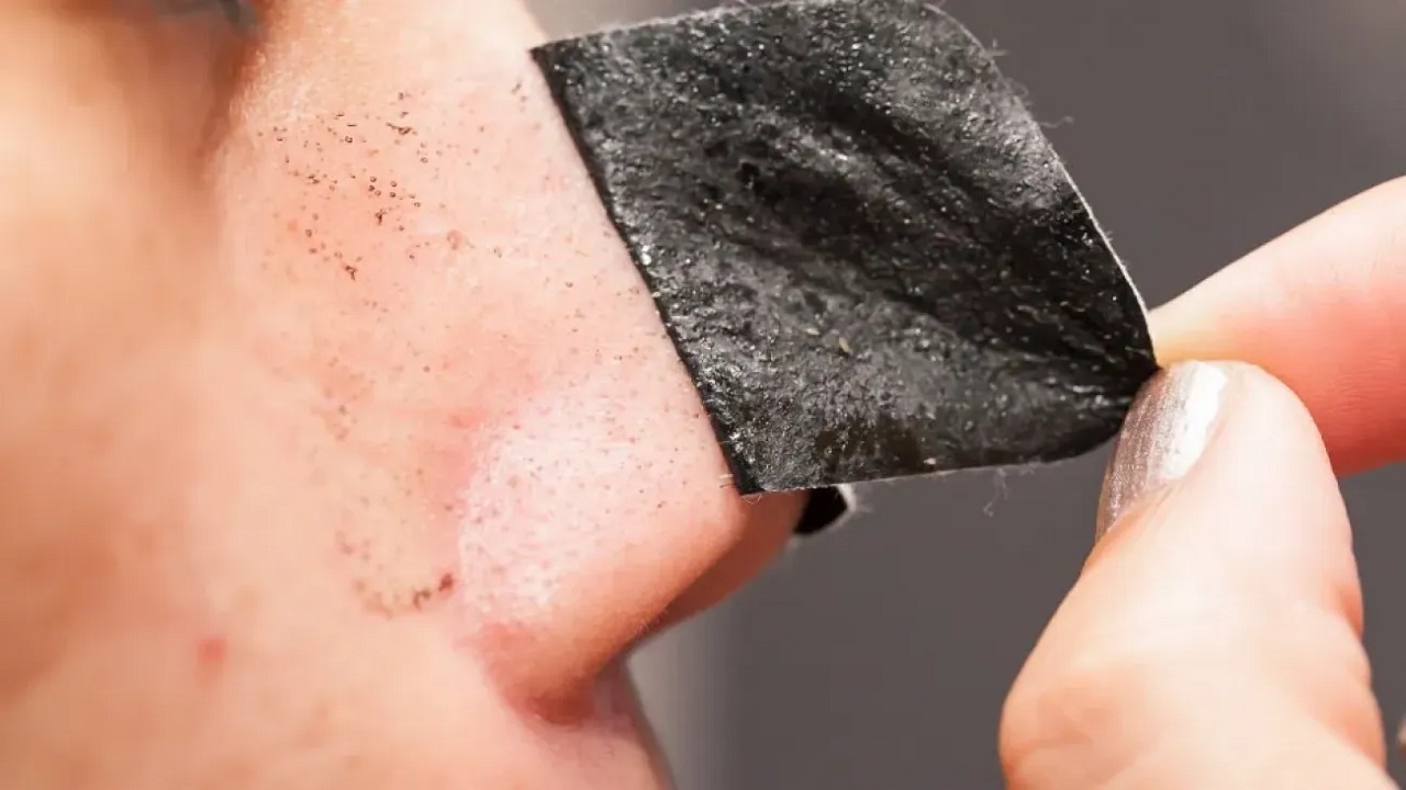 ماسک ذغال برای درمان جوش سر سیاه