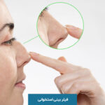 فیلر بینی استخوانی