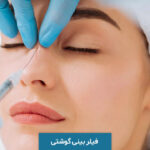 فیلر بینی گوشتی