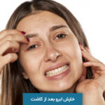 خارش ابرو بعد از کاشت