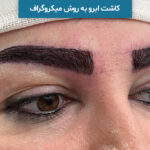 کاشت ابرو به روش میکروگراف