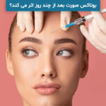 بوتاکس صورت بعد از چند روز اثر می کند؟